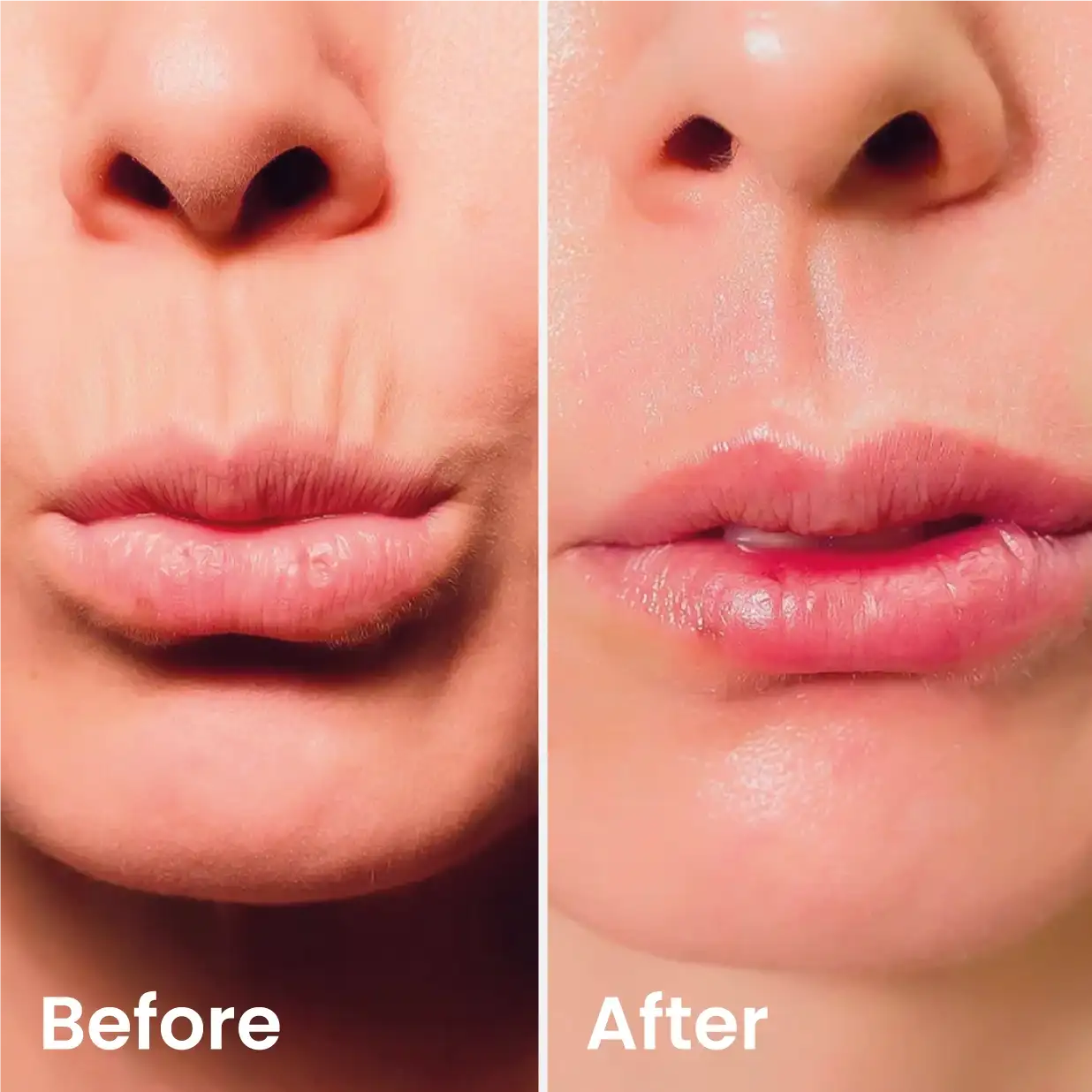 Captily® Rested Skin Balm